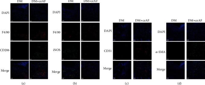 https://cdn.ncbi.nlm.nih.gov/pmc/blobs/ccee/10098416/3b5ccc66ae8b/JDR2023-2422303.005.jpg