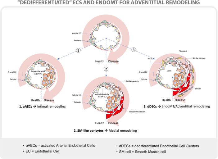 https://cdn.ncbi.nlm.nih.gov/pmc/blobs/ccf6/11693987/1f6414239071/PUL2-15-e70027-g004.jpg