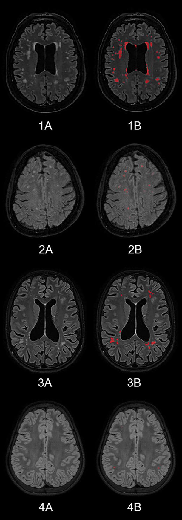 https://cdn.ncbi.nlm.nih.gov/pmc/blobs/ccf7/7592958/0222d73c8858/pone.0241438.g001.jpg