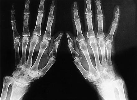 https://cdn.ncbi.nlm.nih.gov/pmc/blobs/ccf8/2628161/c12683cb794b/ymj-48-891-g001.jpg