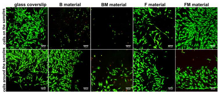 https://cdn.ncbi.nlm.nih.gov/pmc/blobs/ccfa/8038037/90f14f39b200/materials-14-01704-g006.jpg