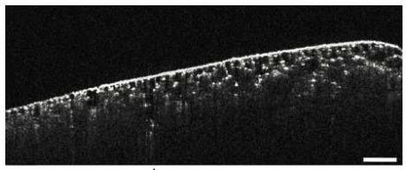 https://cdn.ncbi.nlm.nih.gov/pmc/blobs/ccfd/3342185/fa2e8156e72d/boe-3-5-1101-g001.jpg