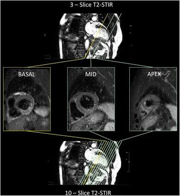 https://cdn.ncbi.nlm.nih.gov/pmc/blobs/cd00/4724400/c3c7a077fcbf/12968_2016_226_Fig1_HTML.jpg
