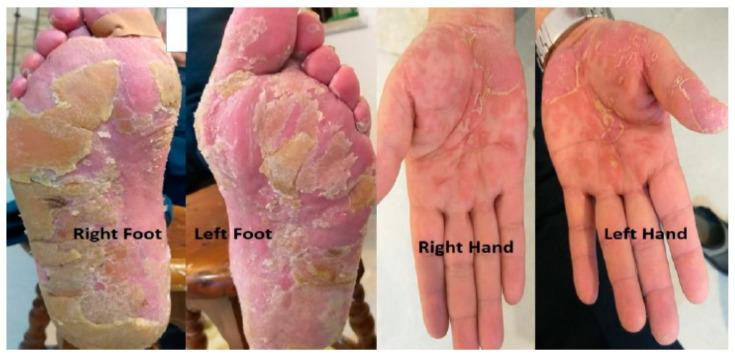 https://cdn.ncbi.nlm.nih.gov/pmc/blobs/cd03/10455121/916cd55975aa/life-13-01657-g003.jpg