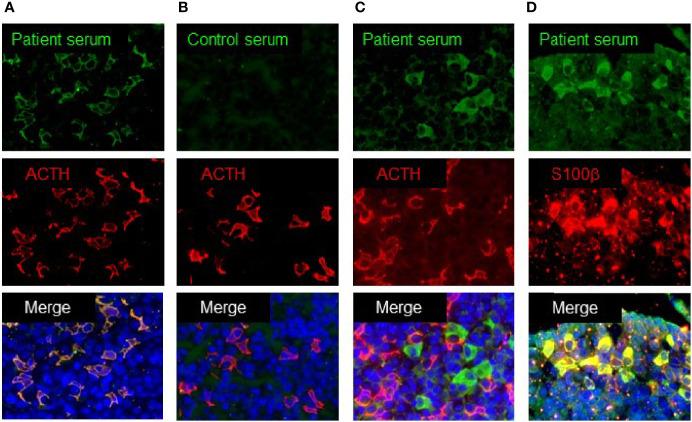https://cdn.ncbi.nlm.nih.gov/pmc/blobs/cd08/7933588/79d50970bc50/fendo-12-578802-g001.jpg