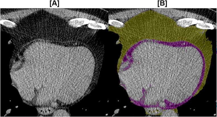 https://cdn.ncbi.nlm.nih.gov/pmc/blobs/cd17/11245900/6e72a661295e/gr1.jpg