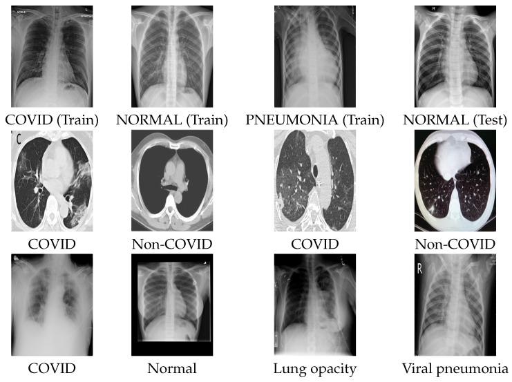 https://cdn.ncbi.nlm.nih.gov/pmc/blobs/cd26/8624090/4a95a6202b2f/entropy-23-01383-g004.jpg