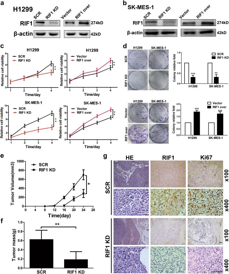 https://cdn.ncbi.nlm.nih.gov/pmc/blobs/cd27/6148239/8b7d3203b050/41419_2018_972_Fig2_HTML.jpg