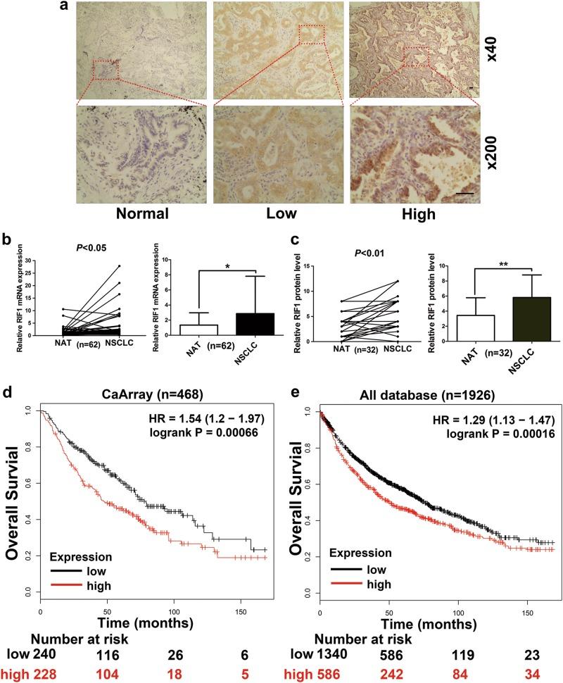 https://cdn.ncbi.nlm.nih.gov/pmc/blobs/cd27/6148239/e64b96122df0/41419_2018_972_Fig1_HTML.jpg