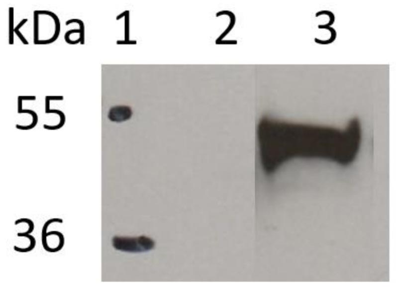 https://cdn.ncbi.nlm.nih.gov/pmc/blobs/cd29/8037128/d5c4f42e1aaf/ijms-22-03547-g003.jpg
