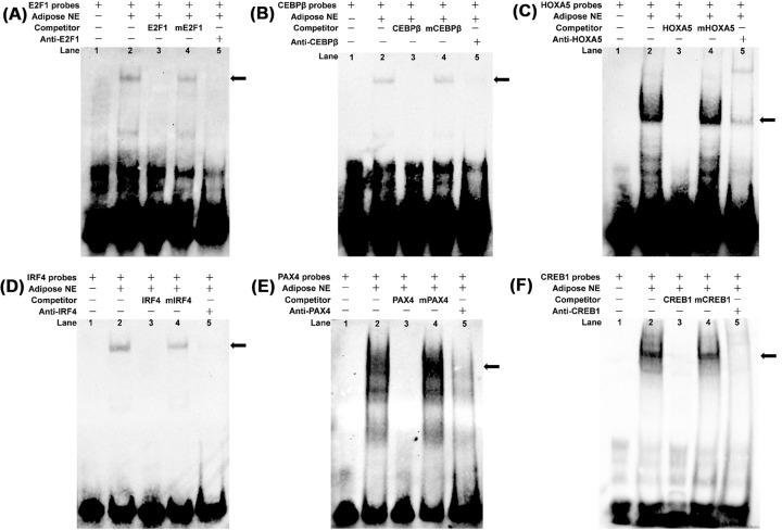 https://cdn.ncbi.nlm.nih.gov/pmc/blobs/cd2c/6294651/8c0782955346/bsr-38-bsr20181705-g4.jpg