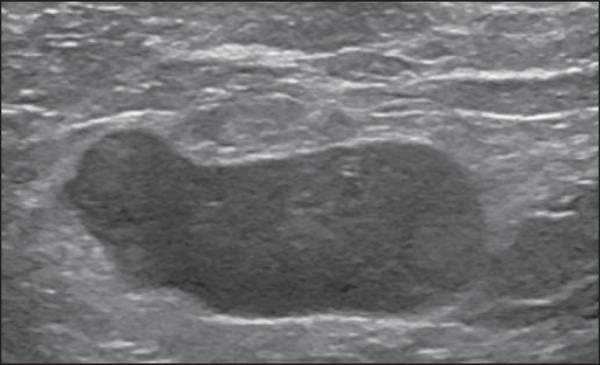 https://cdn.ncbi.nlm.nih.gov/pmc/blobs/cd2d/4337126/13d05b7510a9/rb-47-04-0240-g07.jpg