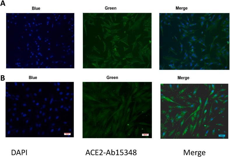 https://cdn.ncbi.nlm.nih.gov/pmc/blobs/cd31/10796980/b17f3e430152/gr4.jpg