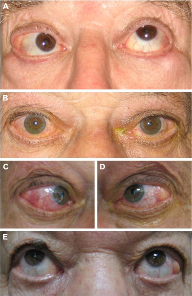 https://cdn.ncbi.nlm.nih.gov/pmc/blobs/cd35/5315218/f7b4ab957c18/cia-12-359Fig4.jpg