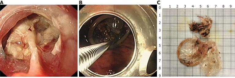 https://cdn.ncbi.nlm.nih.gov/pmc/blobs/cd3c/11843031/e1d7c8d73081/102501-g002.jpg