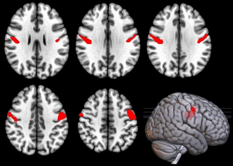 https://cdn.ncbi.nlm.nih.gov/pmc/blobs/cd44/9886651/0bfcb53def48/415_2022_11445_Fig1_HTML.jpg