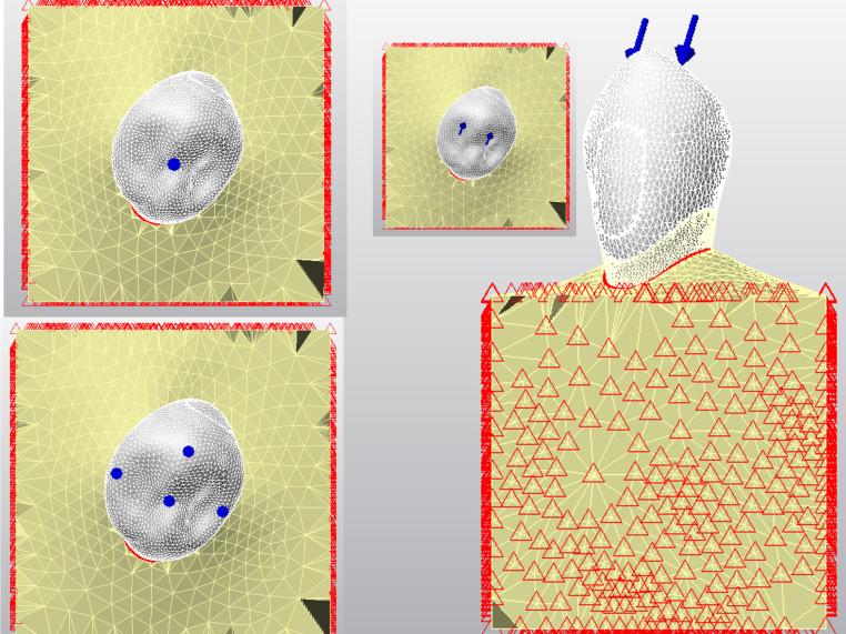 https://cdn.ncbi.nlm.nih.gov/pmc/blobs/cd4a/11258061/e5dc338893eb/784_2024_5808_Fig4_HTML.jpg