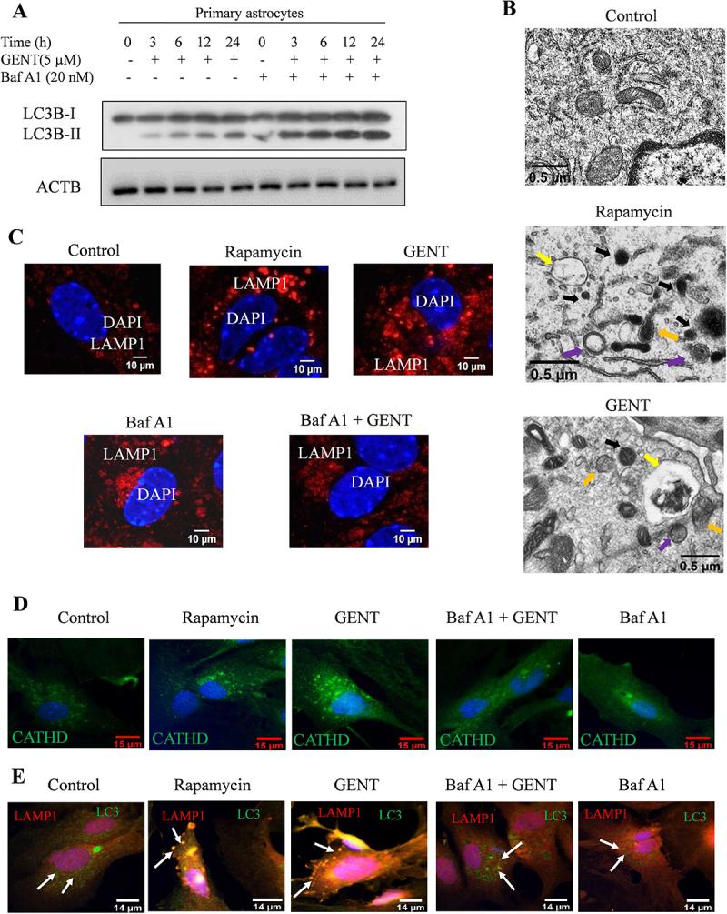 https://cdn.ncbi.nlm.nih.gov/pmc/blobs/cd4a/11864677/7d65e4f61afb/KAUO_A_2296209_F0002_OC.jpg
