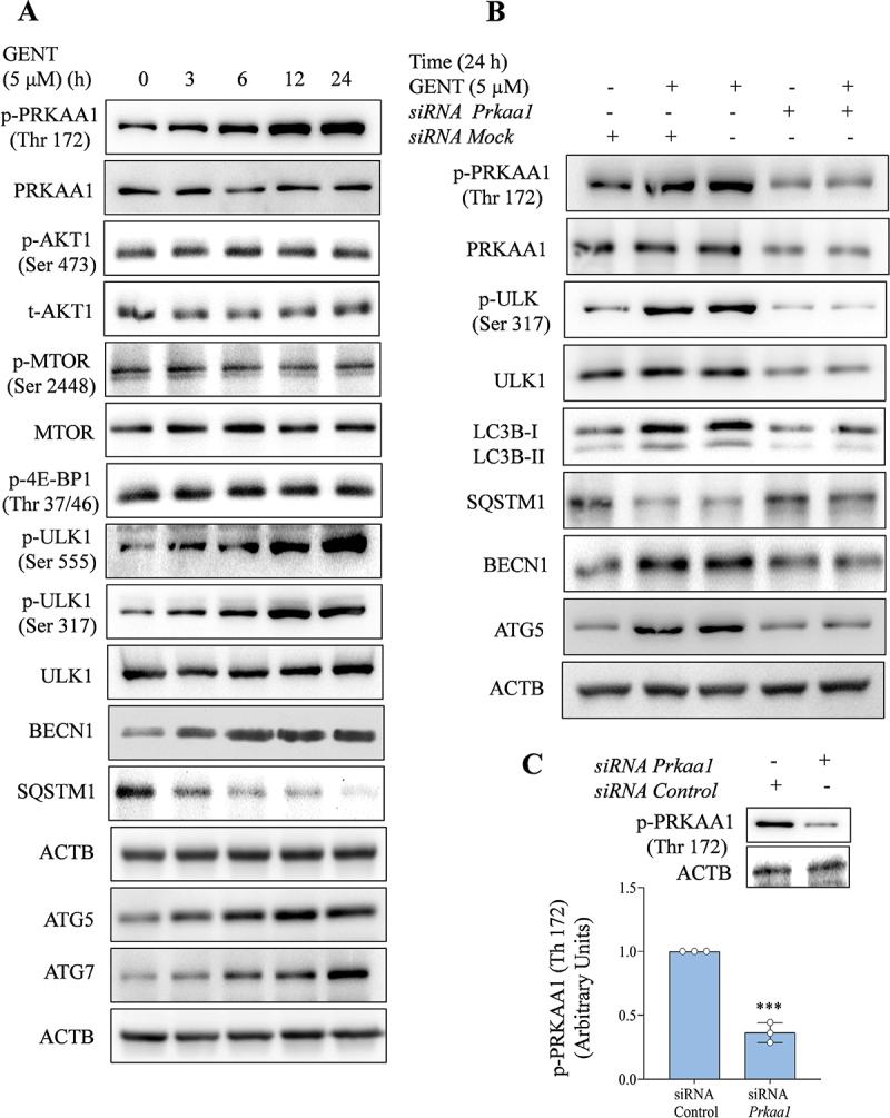 https://cdn.ncbi.nlm.nih.gov/pmc/blobs/cd4a/11864677/f839f7a695d8/KAUO_A_2296209_F0004_OC.jpg