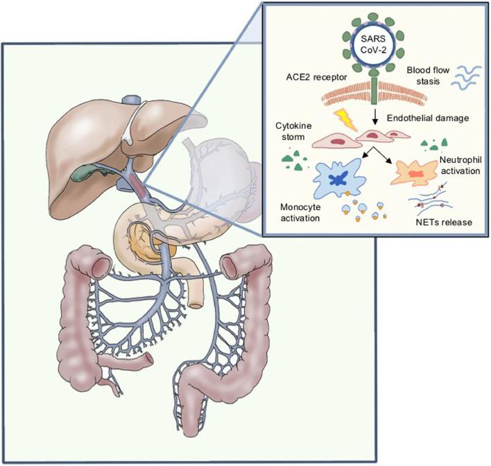 https://cdn.ncbi.nlm.nih.gov/pmc/blobs/cd4a/8149197/159dc0353217/gr1_lrg.jpg