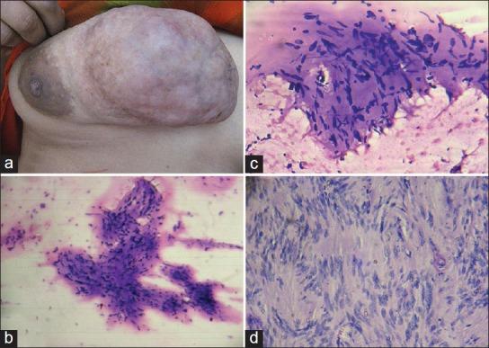 https://cdn.ncbi.nlm.nih.gov/pmc/blobs/cd4d/3543597/d7442e0681ba/JCytol-29-258-g001.jpg