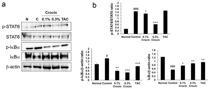 https://cdn.ncbi.nlm.nih.gov/pmc/blobs/cd52/6266819/09d489ffe70c/nutrients-10-01625-g004.jpg