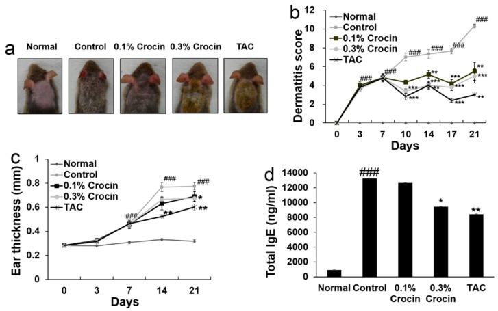 https://cdn.ncbi.nlm.nih.gov/pmc/blobs/cd52/6266819/b951e5957d8d/nutrients-10-01625-g002.jpg
