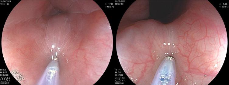 https://cdn.ncbi.nlm.nih.gov/pmc/blobs/cd55/10089276/04b57b0c2865/CEG-16-45-g0001.jpg