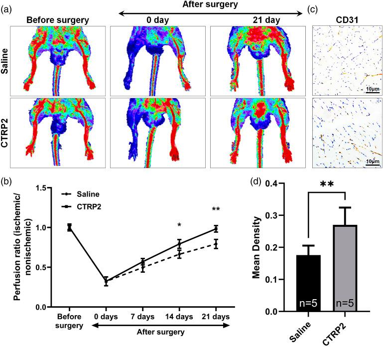 https://cdn.ncbi.nlm.nih.gov/pmc/blobs/cd59/9706074/269750abb009/10.1177_14791641221137355-fig3.jpg