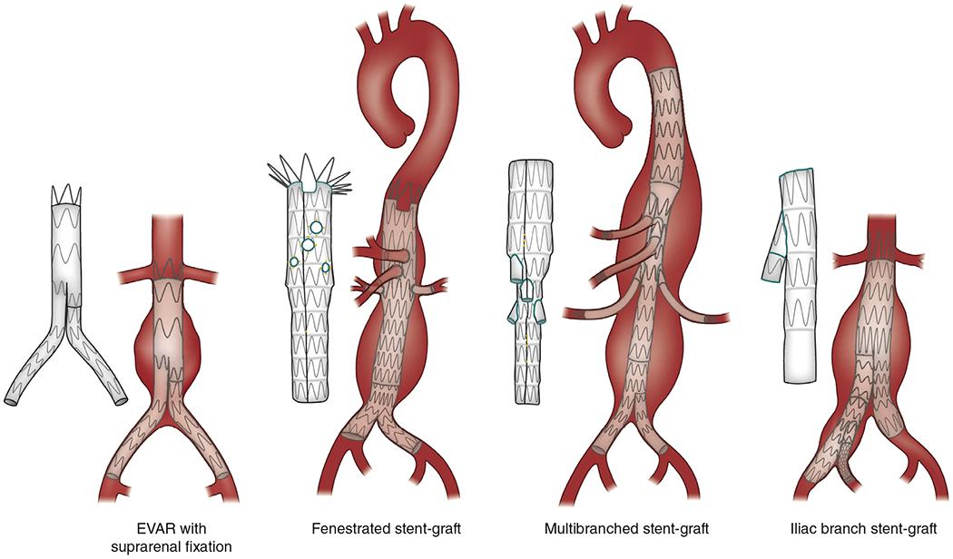 https://cdn.ncbi.nlm.nih.gov/pmc/blobs/cd5c/9833277/293fc5efe234/nihms-1860814-f0003.jpg