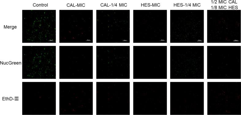 https://cdn.ncbi.nlm.nih.gov/pmc/blobs/cd61/11992792/2b3bb0f0fd6c/12917_2025_4638_Fig6_HTML.jpg