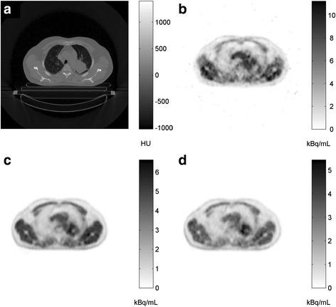 https://cdn.ncbi.nlm.nih.gov/pmc/blobs/cd62/5153396/61cc03c5df2a/40658_2016_167_Fig1_HTML.jpg