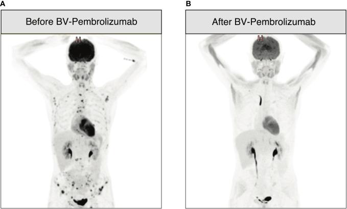 https://cdn.ncbi.nlm.nih.gov/pmc/blobs/cd68/10950903/b7099eef7a88/fimmu-15-1360275-g002.jpg
