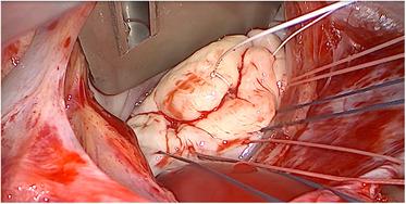 https://cdn.ncbi.nlm.nih.gov/pmc/blobs/cd6b/10272793/d4680e44cba2/fcvm-10-1128195-g002.jpg