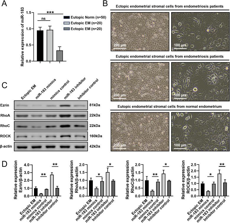 https://cdn.ncbi.nlm.nih.gov/pmc/blobs/cd6e/12234282/717776b655df/fonc-15-1537528-g001.jpg