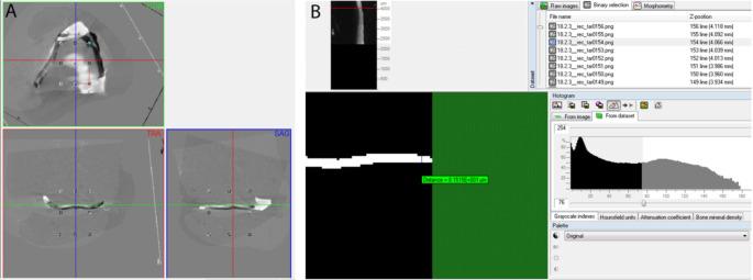 https://cdn.ncbi.nlm.nih.gov/pmc/blobs/cd71/12008063/659de1265eac/784_2025_6336_Fig2_HTML.jpg