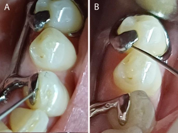 https://cdn.ncbi.nlm.nih.gov/pmc/blobs/cd71/12008063/a9b0bc44c2b5/784_2025_6336_Fig1_HTML.jpg