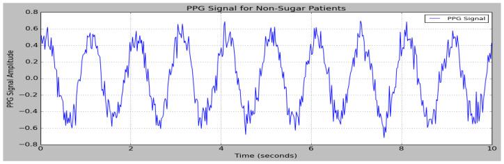 https://cdn.ncbi.nlm.nih.gov/pmc/blobs/cd78/11945921/52bcd6975a2c/sensors-25-01868-g007.jpg