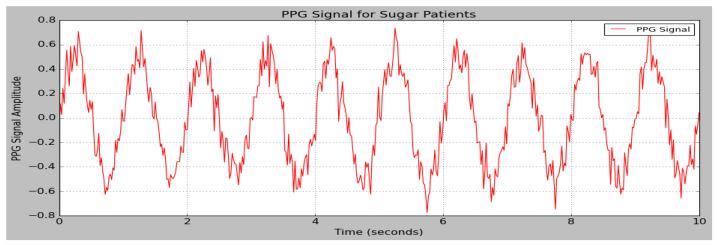 https://cdn.ncbi.nlm.nih.gov/pmc/blobs/cd78/11945921/d398f4d2230c/sensors-25-01868-g006.jpg