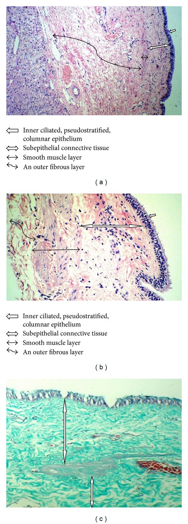 https://cdn.ncbi.nlm.nih.gov/pmc/blobs/cd7a/3814107/fa65406eb2bd/CRIM.MEDICINE2013-372017.002.jpg