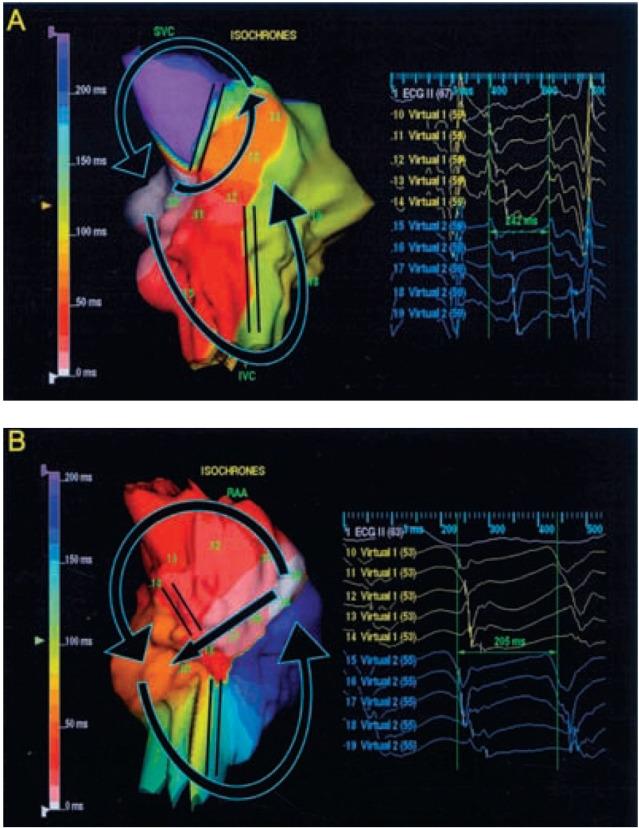 https://cdn.ncbi.nlm.nih.gov/pmc/blobs/cd7d/1501102/aabef5bed126/ipej060119-03.jpg