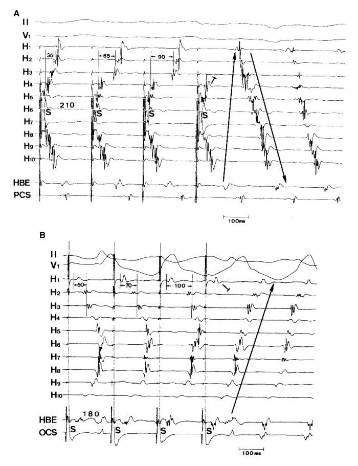 https://cdn.ncbi.nlm.nih.gov/pmc/blobs/cd7d/1501102/b4e35789cda2/ipej060119-01.jpg