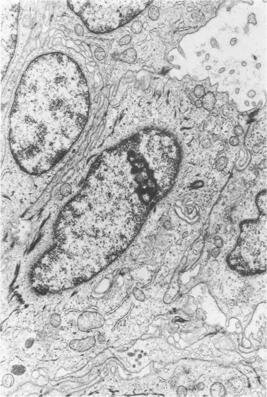 https://cdn.ncbi.nlm.nih.gov/pmc/blobs/cd85/2032290/2e9d318e7073/amjpathol00455-0085-a.jpg