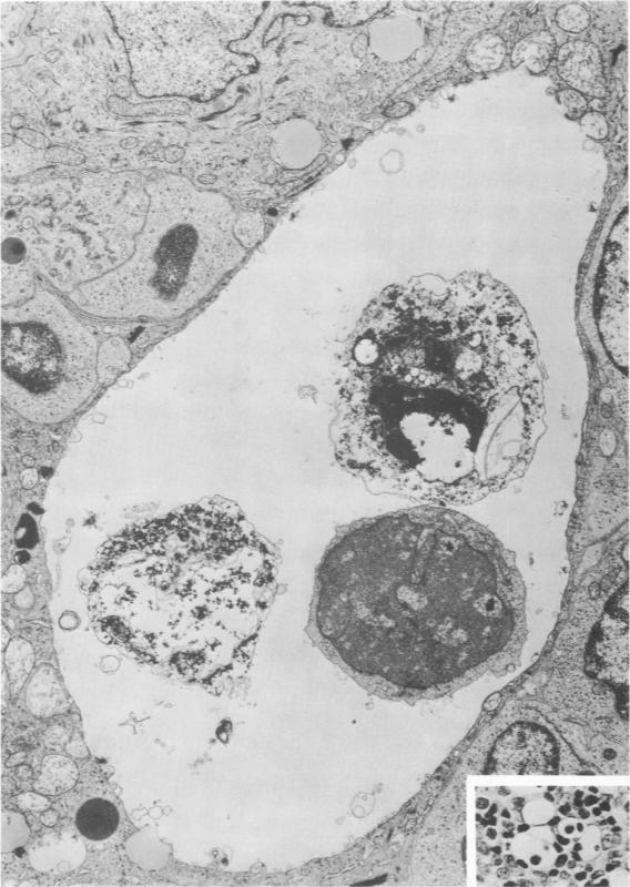 https://cdn.ncbi.nlm.nih.gov/pmc/blobs/cd85/2032290/3bc5f10c32ed/amjpathol00455-0087-a.jpg