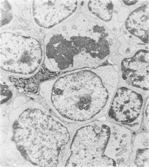 https://cdn.ncbi.nlm.nih.gov/pmc/blobs/cd85/2032290/c57a915aff12/amjpathol00455-0089-a.jpg