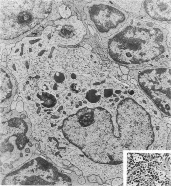 https://cdn.ncbi.nlm.nih.gov/pmc/blobs/cd85/2032290/cc427924862a/amjpathol00455-0090-a.jpg