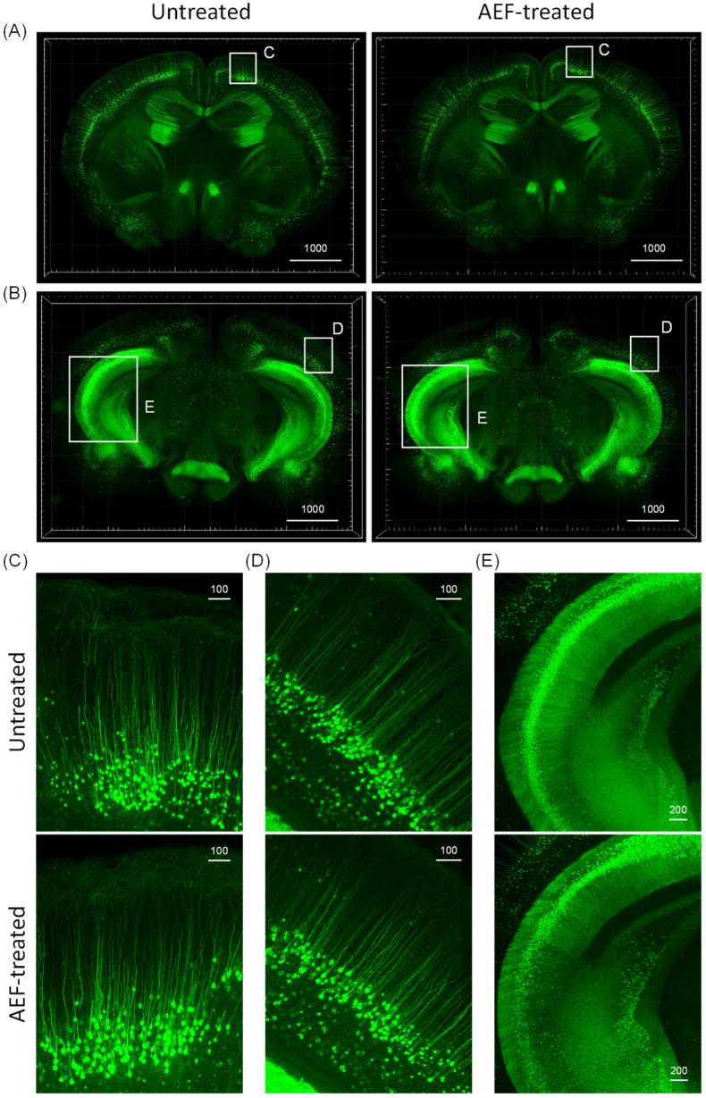 https://cdn.ncbi.nlm.nih.gov/pmc/blobs/cd8d/10254001/7e61324ea1a5/ijms-24-09552-g007.jpg