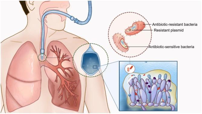 https://cdn.ncbi.nlm.nih.gov/pmc/blobs/cd90/7889970/b6debfa623b5/fmed-07-598037-g0001.jpg