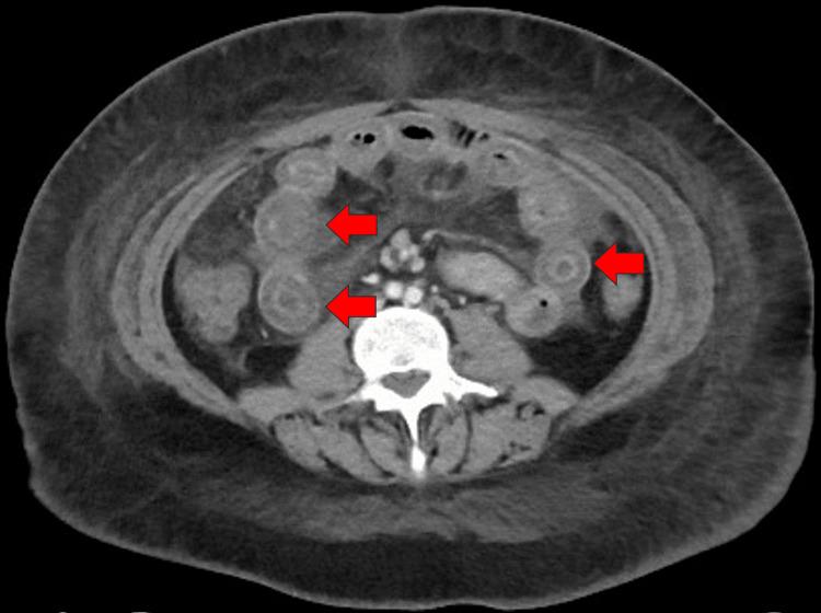 https://cdn.ncbi.nlm.nih.gov/pmc/blobs/cd95/11791376/d3c0265c142f/cureus-0017-00000076926-i01.jpg