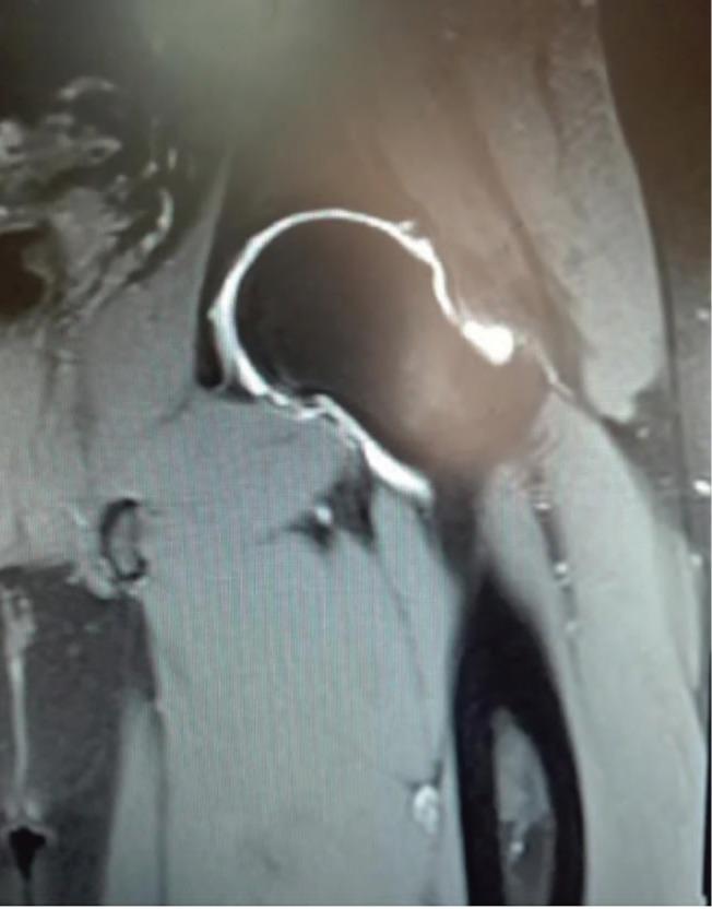 https://cdn.ncbi.nlm.nih.gov/pmc/blobs/cda0/6726866/c0756d3110a9/hp-31-129-g005.jpg